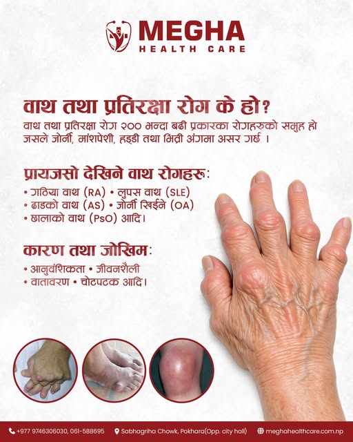 Arthritis & Rheumatology Information